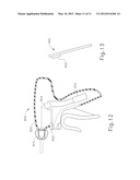 SELECTIVE ACTIVATION OF ELECTRONIC COMPONENTS IN MEDICAL DEVICE diagram and image