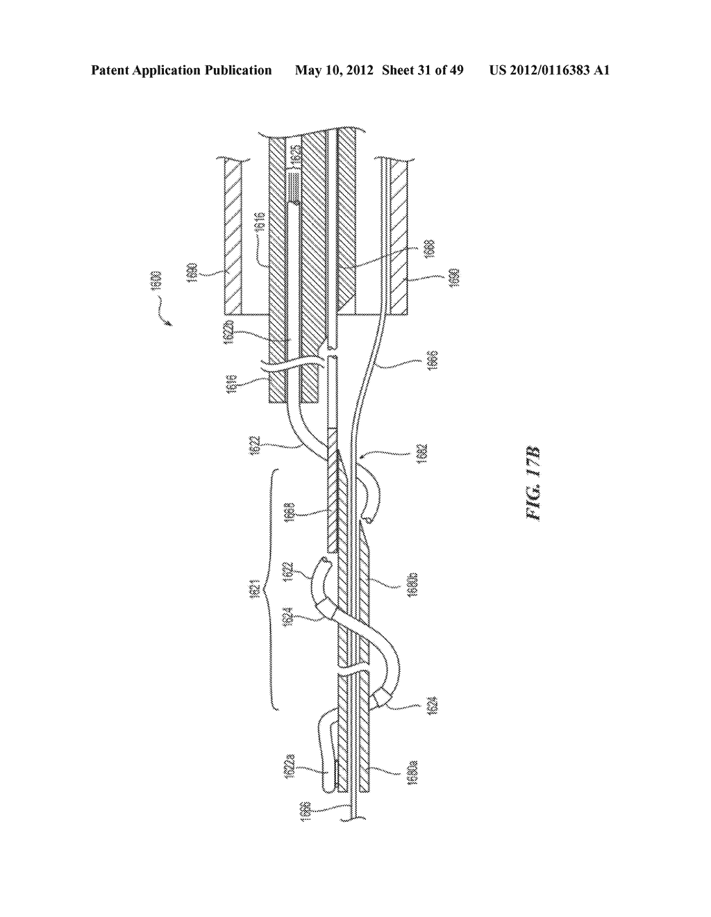 CATHETER APPARATUSES HAVING MULTI-ELECTRODE ARRAYS FOR RENAL     NEUROMODULATION AND ASSOCIATED SYSTEMS AND METHODS - diagram, schematic, and image 32