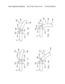 ARTICULATED SURGICAL PROBE AND METHOD FOR USE diagram and image