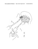 ARTICULATED SURGICAL PROBE AND METHOD FOR USE diagram and image