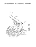 ARTICULATED SURGICAL PROBE AND METHOD FOR USE diagram and image