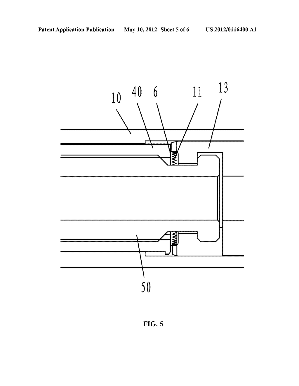 FIXATION DEVICE FOR INTRAMEDULLARY NAIL - diagram, schematic, and image 06