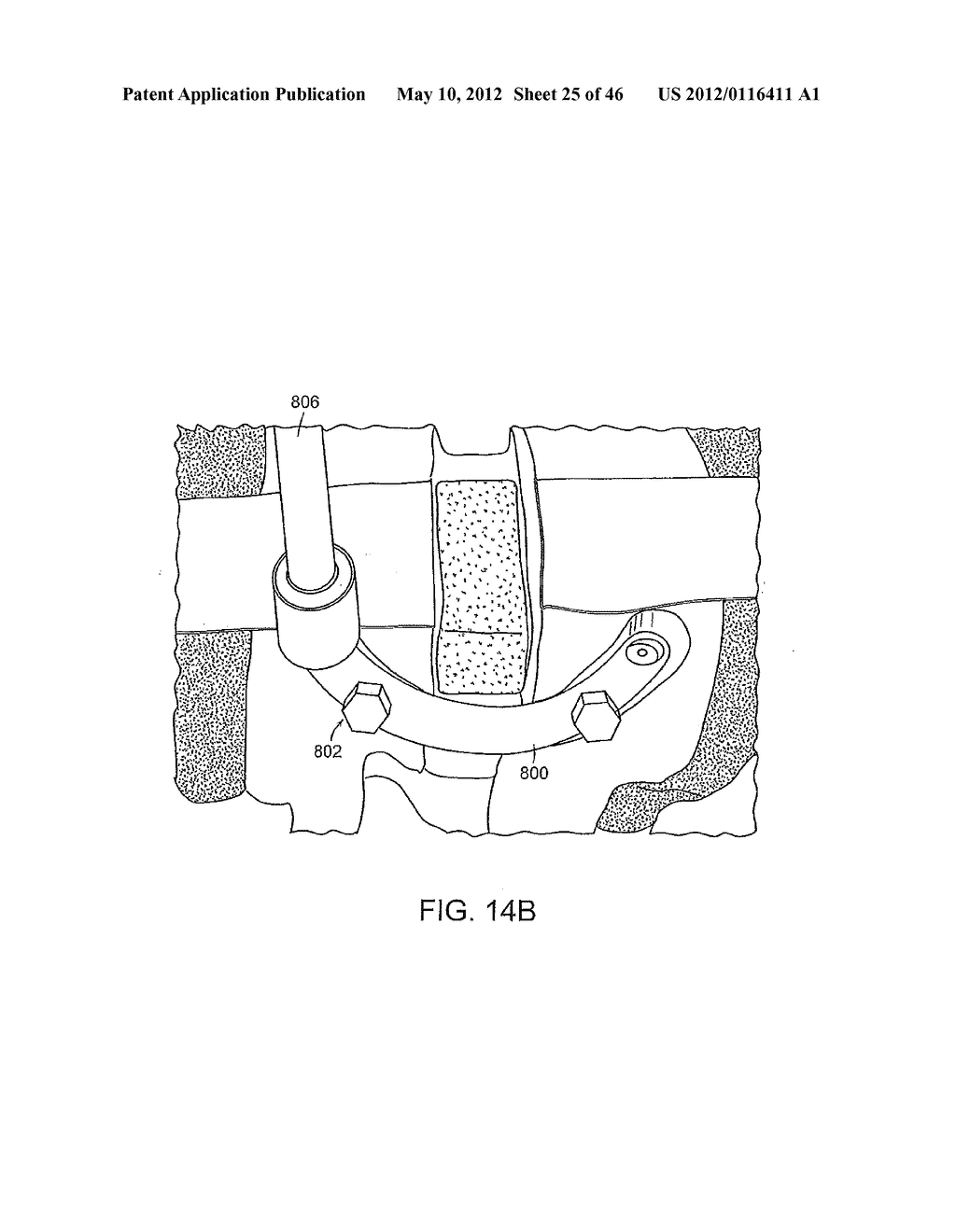 SYSTEMS, DEVICES AND APPARATUSES FOR BONY FIXATION AND DISK REPAIR AND     REPLACEMENT METHODS RELATED THERETO - diagram, schematic, and image 26