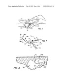 SYSTEM AND METHOD OF HIP REPLACEMENT diagram and image