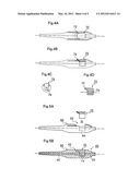 INDWELLING DEVICE FOR TUBULAR MEDICAL TREATMENT INSTRUMENT AND FRONT TIP     OF INDWELLING DEVICE FOR TUBULAR MEDICAL TREATMENT INSTRUMENT diagram and image