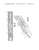 ENDOSCOPIC SURGICAL CLIP APPLIER WITH CONNECTOR PLATE diagram and image