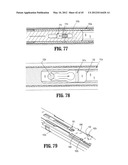 ENDOSCOPIC SURGICAL CLIP APPLIER WITH CONNECTOR PLATE diagram and image