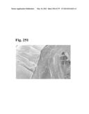 ADHESIVE COMPOUNDS AND METHODS USE FOR HERNIA REPAIR diagram and image