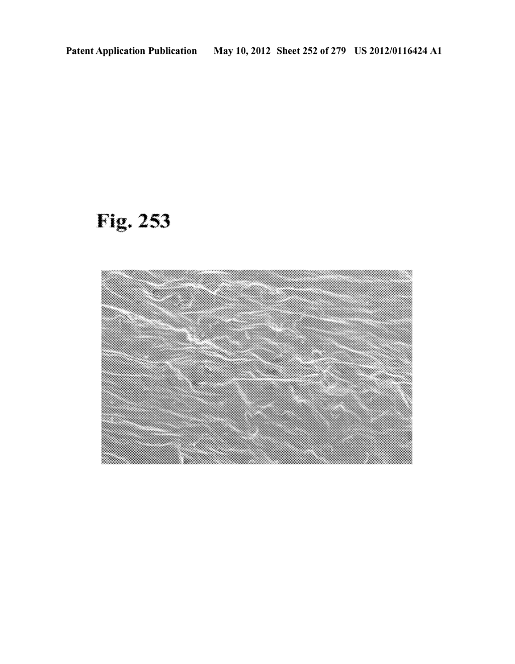 ADHESIVE COMPOUNDS AND METHODS USE FOR HERNIA REPAIR - diagram, schematic, and image 253