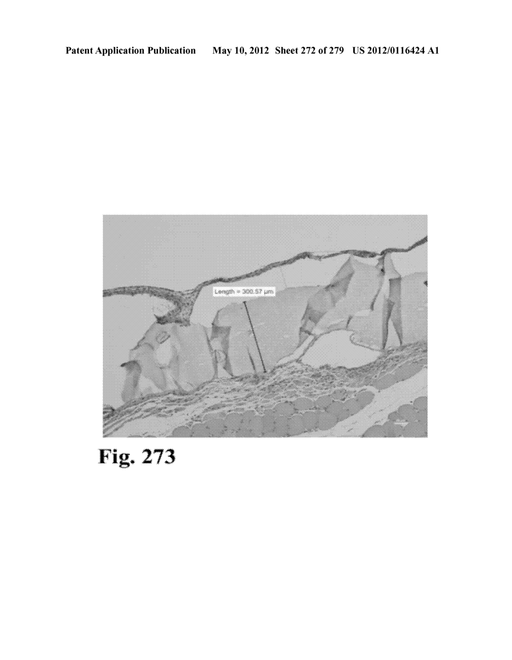 ADHESIVE COMPOUNDS AND METHODS USE FOR HERNIA REPAIR - diagram, schematic, and image 273