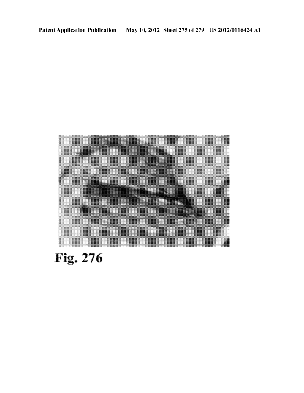 ADHESIVE COMPOUNDS AND METHODS USE FOR HERNIA REPAIR - diagram, schematic, and image 276