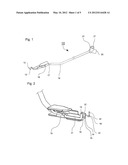 DEVICE FOR PRODUCING ANASTOMOSES diagram and image