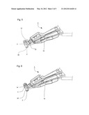 DEVICE FOR PRODUCING ANASTOMOSES diagram and image