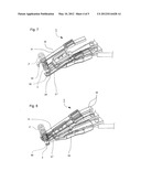 DEVICE FOR PRODUCING ANASTOMOSES diagram and image