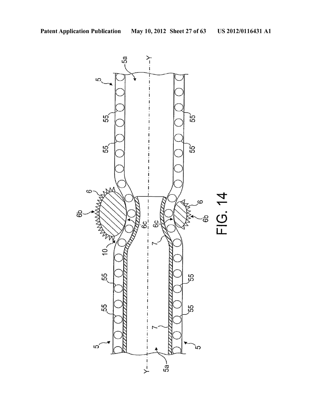 Rotational Atherectomy Device with Distal Protection Capability and Method     of Use - diagram, schematic, and image 28