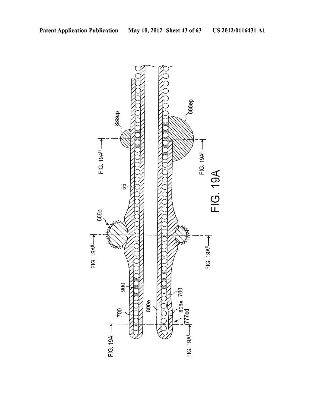 Rotational Atherectomy Device with Distal Protection Capability and Method     of Use - diagram, schematic, and image 44