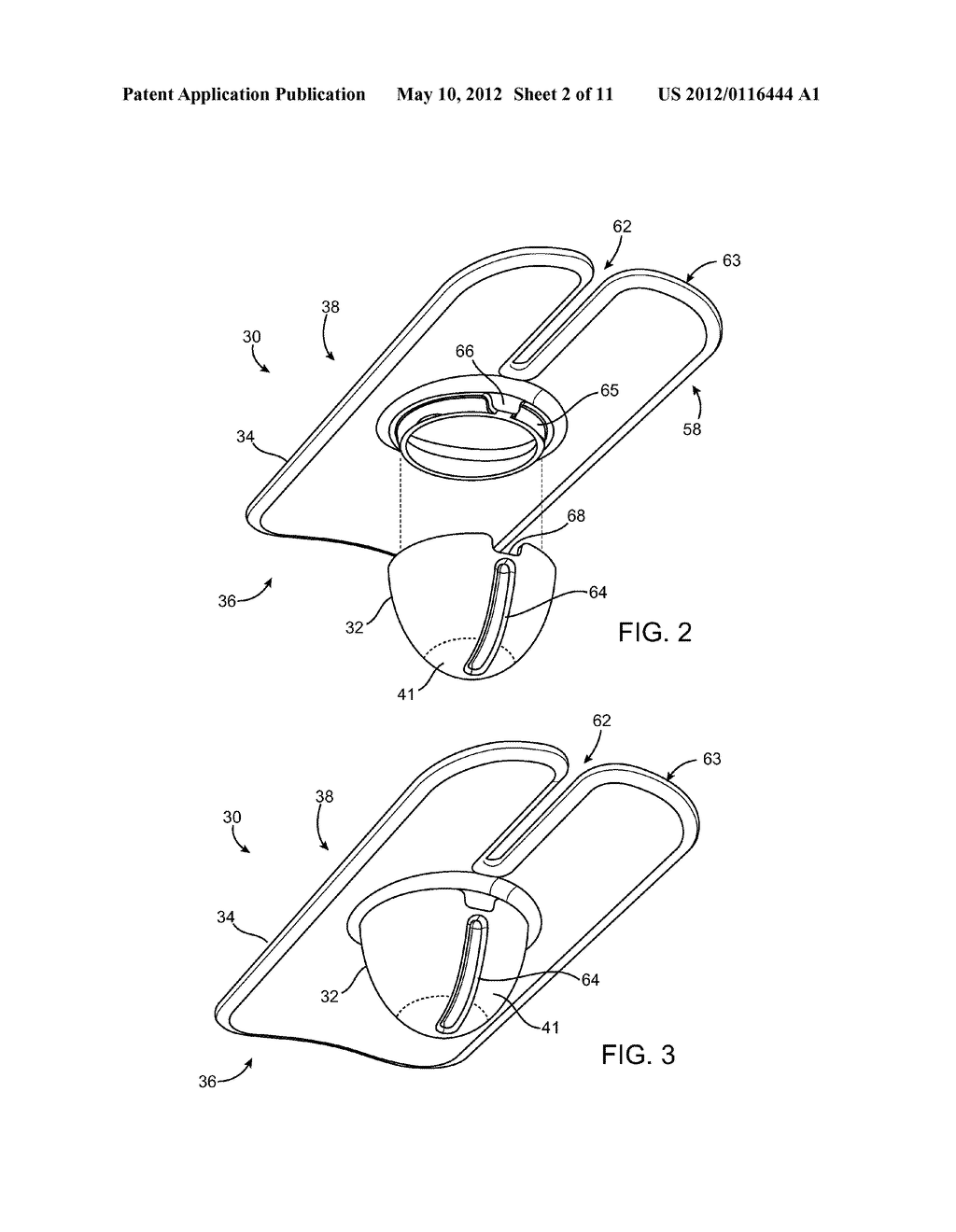 APPARATUSES AND METHODS FOR TREATING WOUNDS - diagram, schematic, and image 03