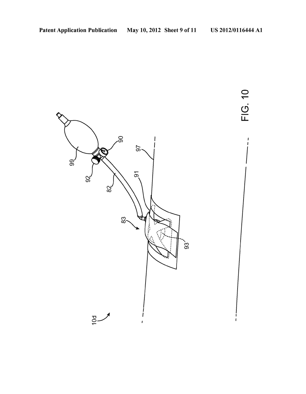 APPARATUSES AND METHODS FOR TREATING WOUNDS - diagram, schematic, and image 10