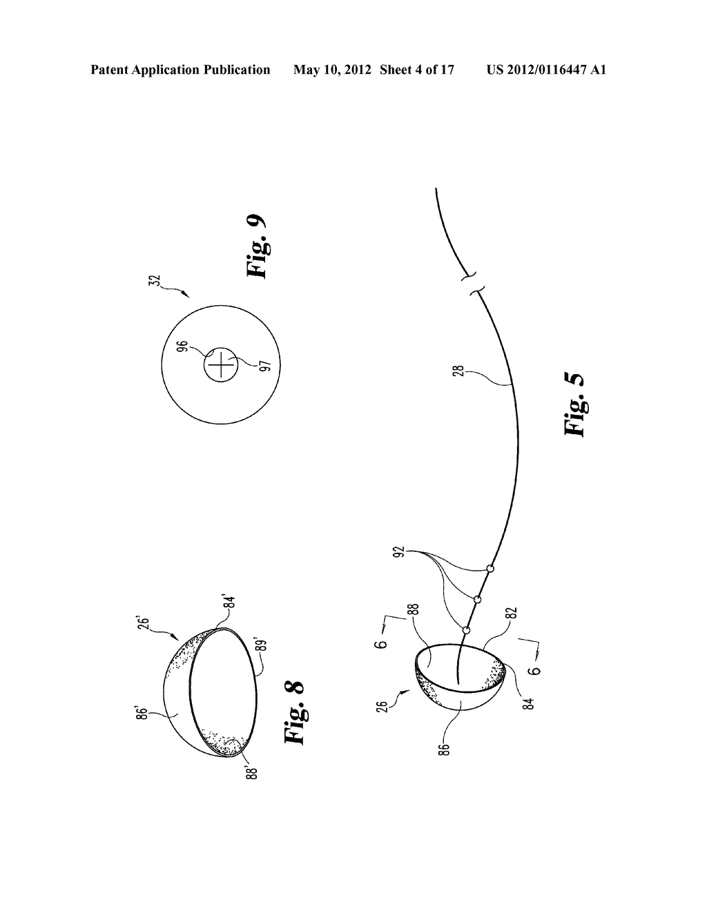 DEVICES AND METHODS USEFUL FOR SEALING BODILY OPENINGS - diagram, schematic, and image 05