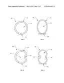 Stabilizer for assisting stabilization of a spinal implant and method of     using the stabilizer diagram and image