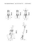 Instruments and Methods for Removing Fixation Devices from Intervertebral     Implants diagram and image