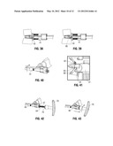 Instruments and Methods for Removing Fixation Devices from Intervertebral     Implants diagram and image