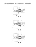 Instruments and Methods for Removing Fixation Devices from Intervertebral     Implants diagram and image