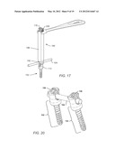 SURGICAL INSTRUMENT WITH INTEGRATED COMPRESSION AND DISTRACTION MECHANISMS diagram and image