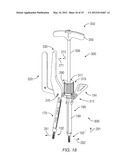 SURGICAL INSTRUMENT WITH INTEGRATED COMPRESSION AND DISTRACTION MECHANISMS diagram and image