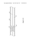 OCCLUSION CROSSING DEVICE AND METHOD diagram and image