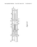 OCCLUSION CROSSING DEVICE AND METHOD diagram and image