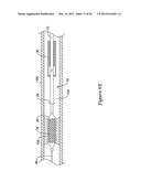 OCCLUSION CROSSING DEVICE AND METHOD diagram and image