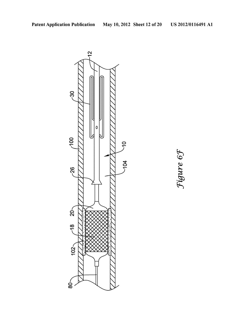 OCCLUSION CROSSING DEVICE AND METHOD - diagram, schematic, and image 13