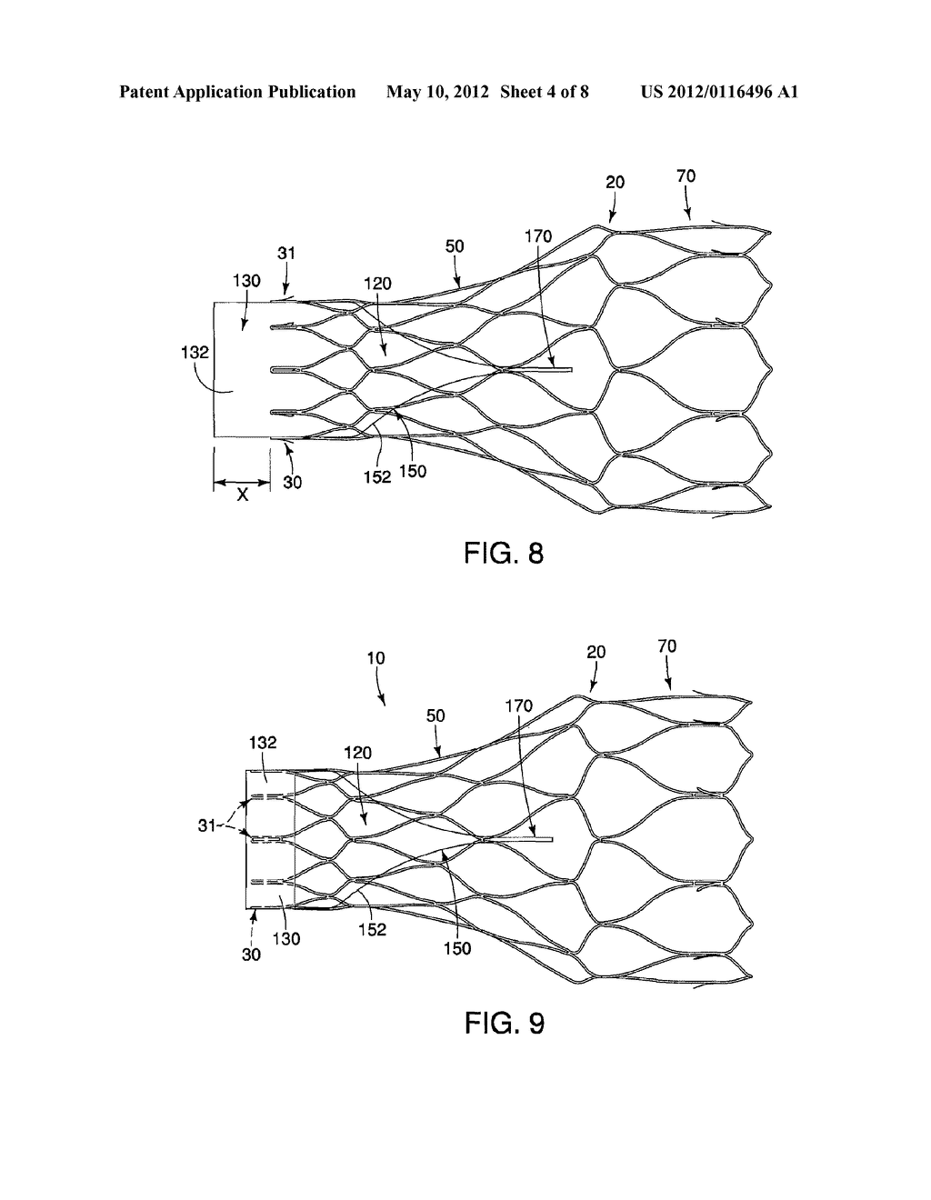 STENT STRUCTURES FOR USE WITH VALVE REPLACEMENTS - diagram, schematic, and image 05