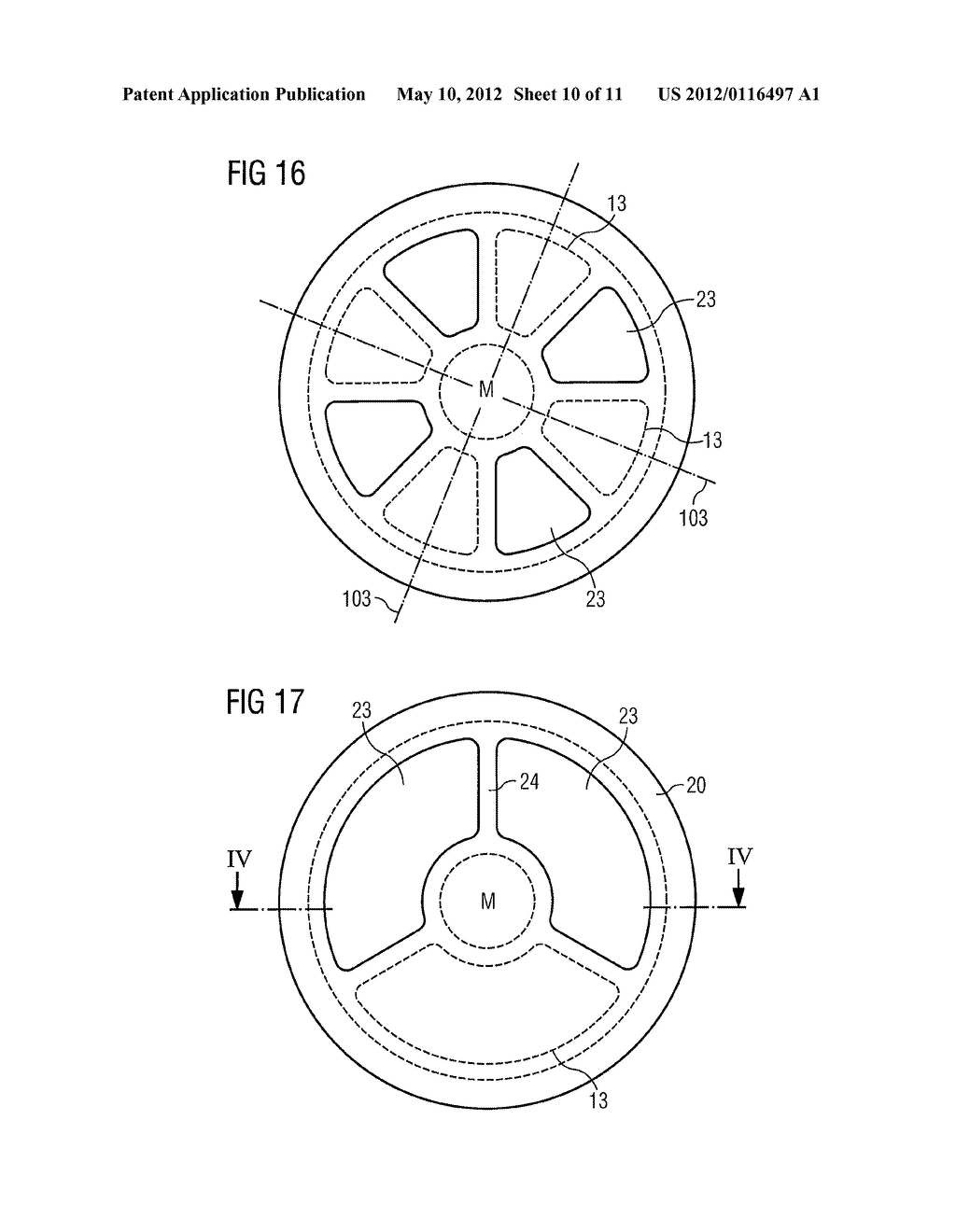 ARTIFICIAL VALVE FOR IMPLANTATION - diagram, schematic, and image 11