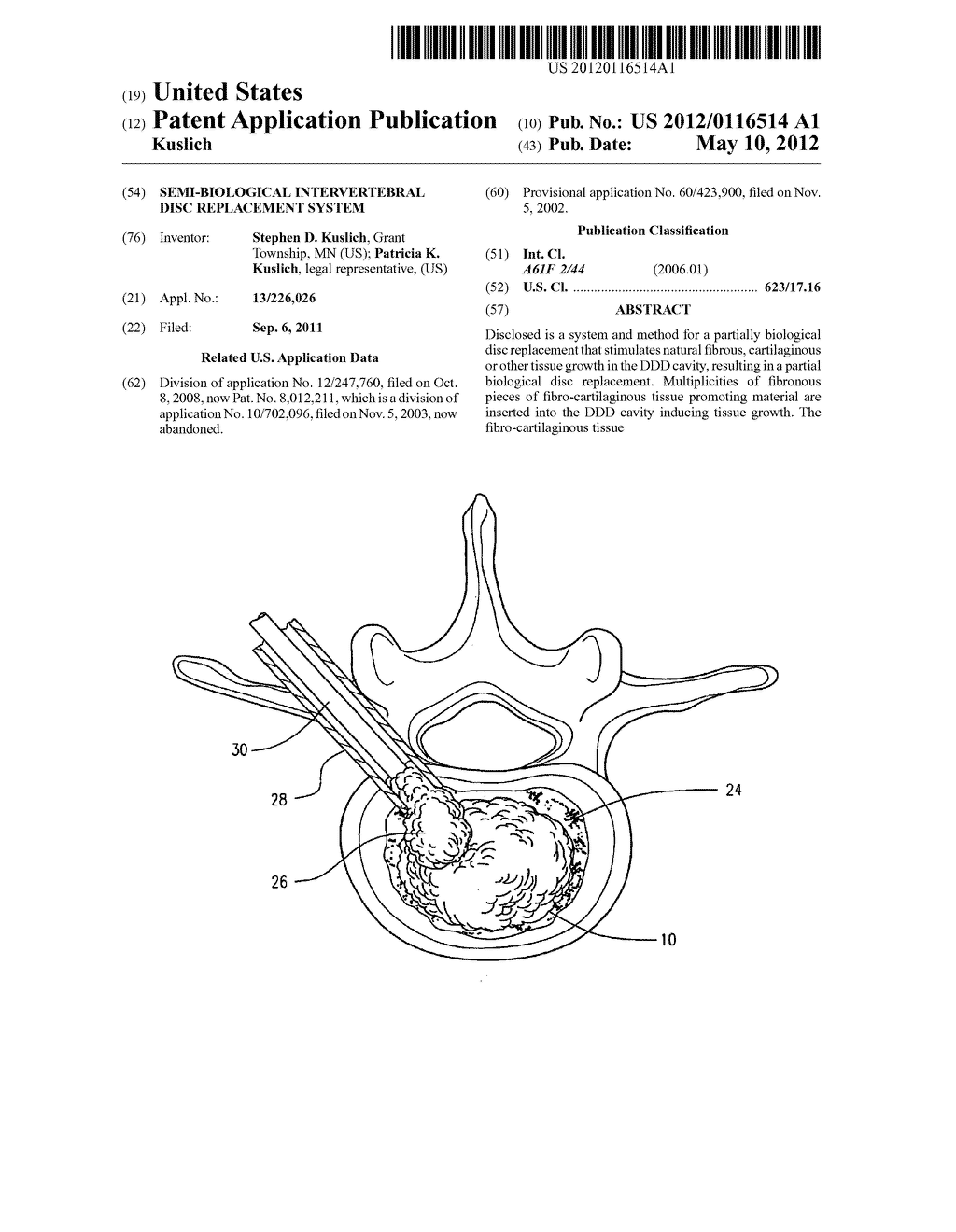 SEMI-BIOLOGICAL INTERVERTEBRAL DISC REPLACEMENT SYSTEM - diagram, schematic, and image 01