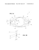 ARTIFICIAL DISC PROSTHESIS FOR REPLACING A DAMAGED NUCLEUS diagram and image