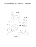 ARTIFICIAL DISC PROSTHESIS FOR REPLACING A DAMAGED NUCLEUS diagram and image