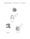 MODULAR LONG BONE PROSTHESIS diagram and image