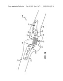 ADJUSTABLE ABSORBER DESIGNS FOR IMPLANTABLE DEVICE diagram and image