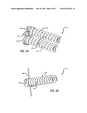 ADJUSTABLE ABSORBER DESIGNS FOR IMPLANTABLE DEVICE diagram and image