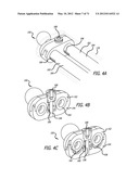 ADJUSTABLE ABSORBER DESIGNS FOR IMPLANTABLE DEVICE diagram and image