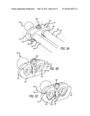 ADJUSTABLE ABSORBER DESIGNS FOR IMPLANTABLE DEVICE diagram and image