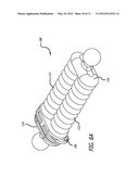 ADJUSTABLE ABSORBER DESIGNS FOR IMPLANTABLE DEVICE diagram and image