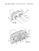 ADJUSTABLE ABSORBER DESIGNS FOR IMPLANTABLE DEVICE diagram and image