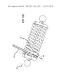 ADJUSTABLE ABSORBER DESIGNS FOR IMPLANTABLE DEVICE diagram and image