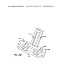 ADJUSTABLE ABSORBER DESIGNS FOR IMPLANTABLE DEVICE diagram and image