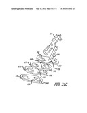 ADJUSTABLE ABSORBER DESIGNS FOR IMPLANTABLE DEVICE diagram and image