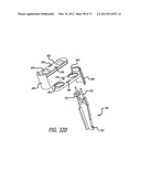 ADJUSTABLE ABSORBER DESIGNS FOR IMPLANTABLE DEVICE diagram and image