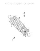 ADJUSTABLE ABSORBER DESIGNS FOR IMPLANTABLE DEVICE diagram and image